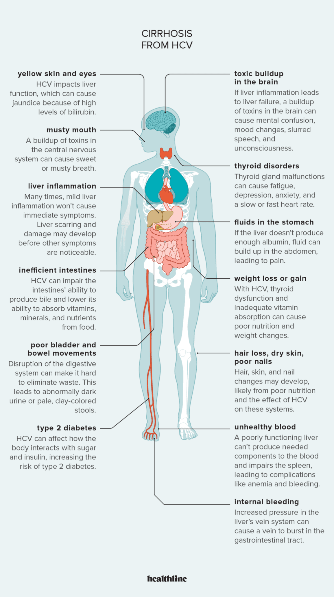 Can Viral Infections Like Hepatitis Cause Long-Term Liver Damage