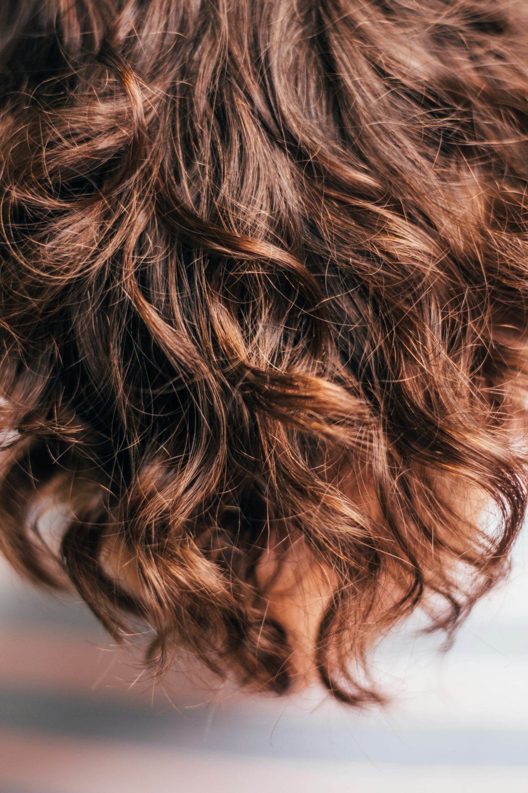 Understanding If Ozempic Can Cause Hair Loss